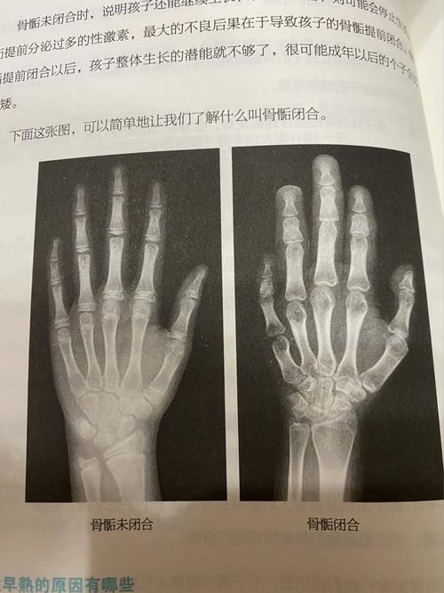 发育的的大拇指那里会出现籽骨.我们还没有.