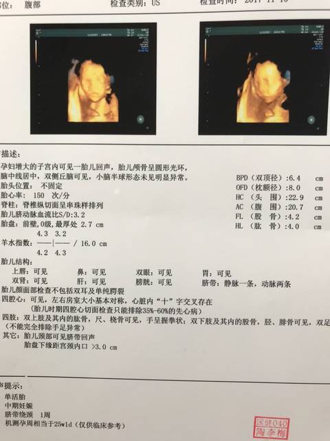 六个月四维彩超男孩图六个月男孩四维彩超图