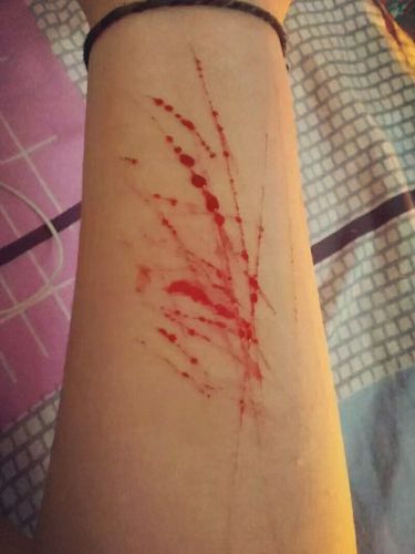 伤口 刀