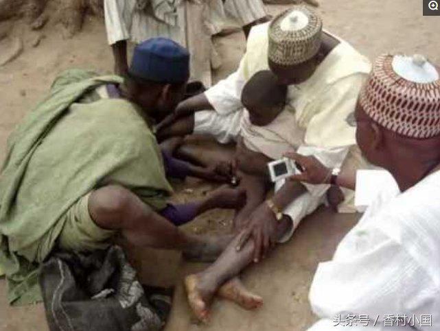 强迫割礼:非洲青少年的"鬼门关",很多少男少女因感染而死