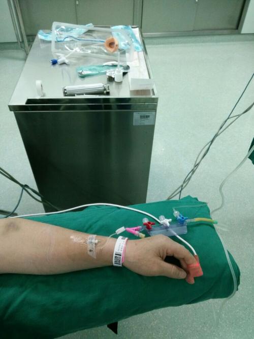 手术病人静脉留置针穿刺部位及型号