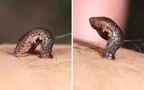 这种虫子 逮住机会就贴你身上吸血,叮完伤口还可能会感染,又恶心又