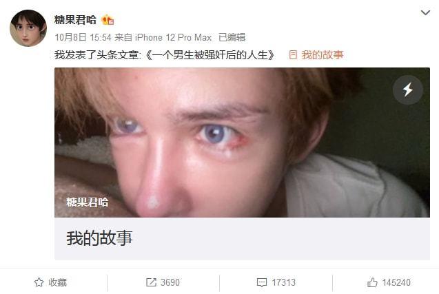 20岁网红被发现家中自杀,多处割伤紧急送医,事前曾经历长期网暴