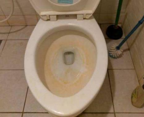 马桶又黄又脏怎么办? 教你这一招, 洗完马桶和新的一样