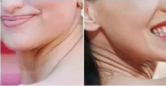 脖子是通身上下最先衰老的部位 很早之前就听人说过 如果脖子不好好