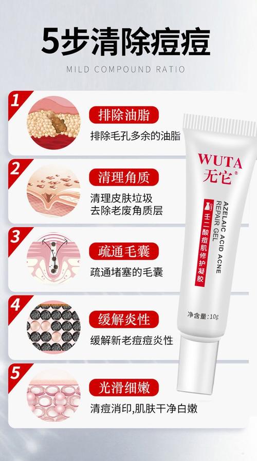 无它壬二酸凝胶15%壬二酸淡化痘印痘坑痘疤修护痘凝露
