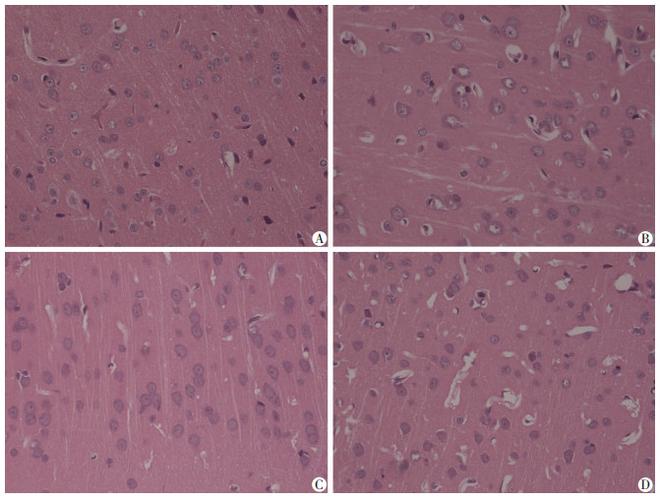 c组脑组织结构正常,胞质与胞核结构清晰;h组细胞肿胀,胞质疏松,细胞