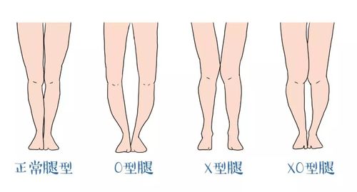 腿型对号入座才能显瘦,显高,显腿长!视觉上秒瘦10斤!