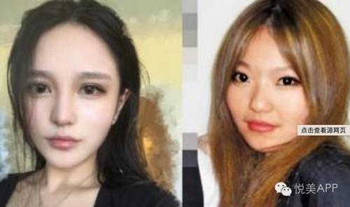 她去磨骨就变成瓜子脸