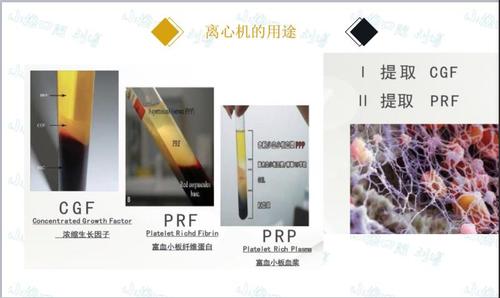 cgf与prp疗效对比