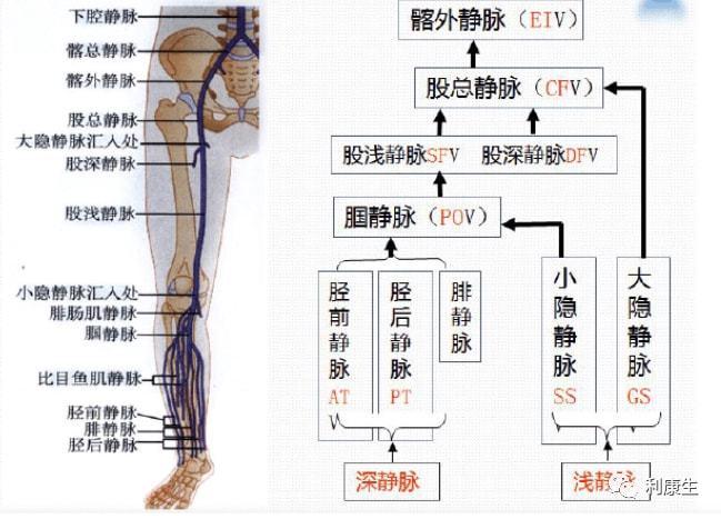 下肢静脉曲张的病因是什么