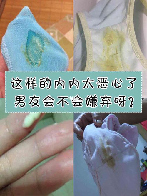9191内裤每天都换还是湿哒哒的!白带异常真的太烦人了!