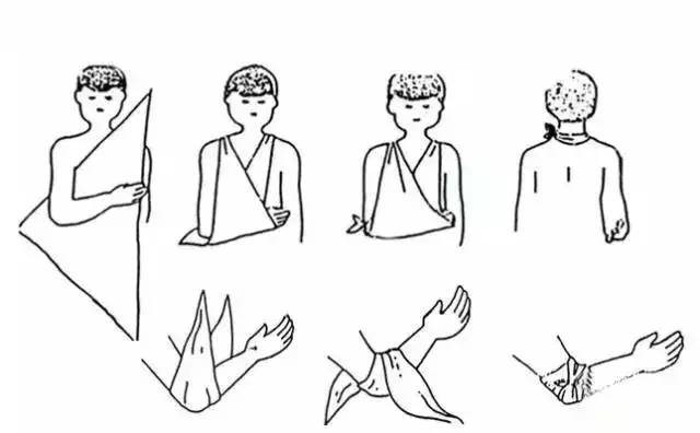 常用的包扎材料有 a href="#" data-lemmaid="1976762">三角巾 /a>和