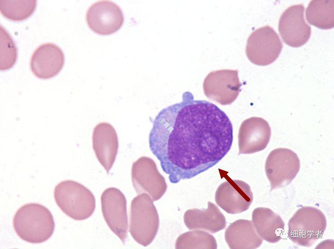 原始单核细胞   15