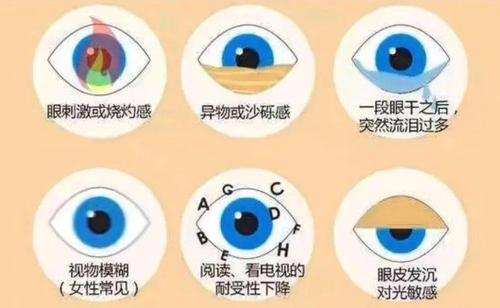 小年夜特辑:眼干,眼痒如何缓解眼部不适症状?