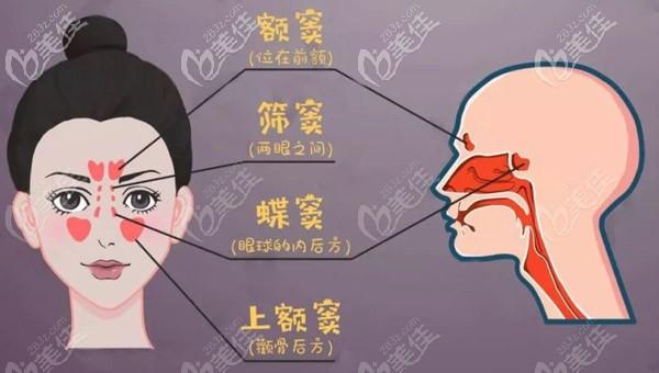 关于种植牙上颌窦提升术很多人都有疑虑,今天我们主要解决两个问题