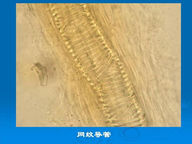中药显微鉴别 网纹导管
