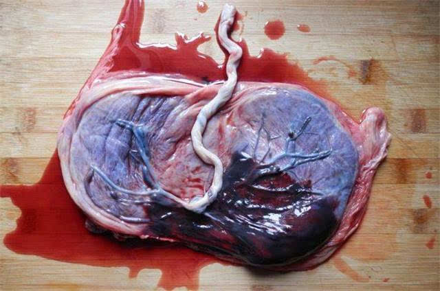 胎盘真的能吃吗?