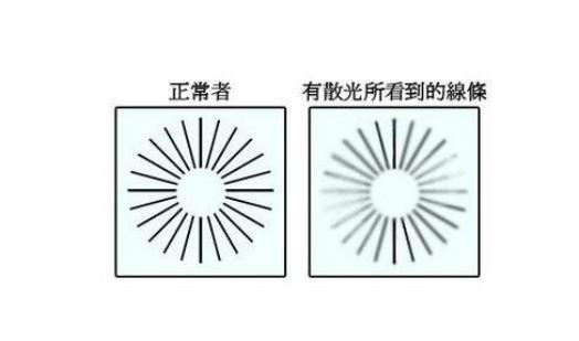 什么是散光?看完立即涨知识,轻松在家玩自测!