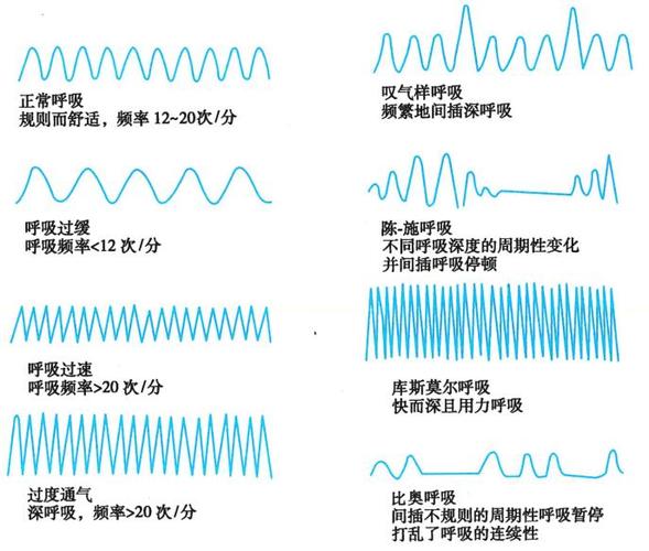 异常呼吸类型