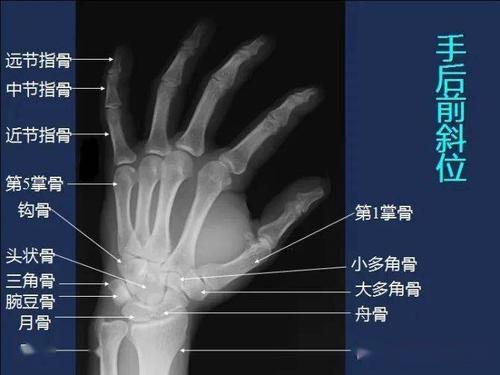 影像解剖全身常规x线骨关节mri断层解剖大全