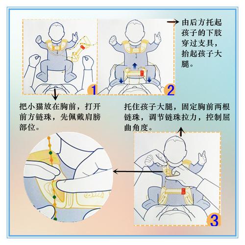 儿童髋外展矫形器髋关节发育不良脱位蛙式架正品