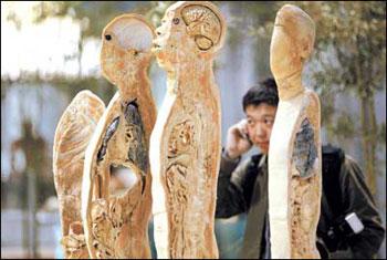 人体前后方向连续切片标本.