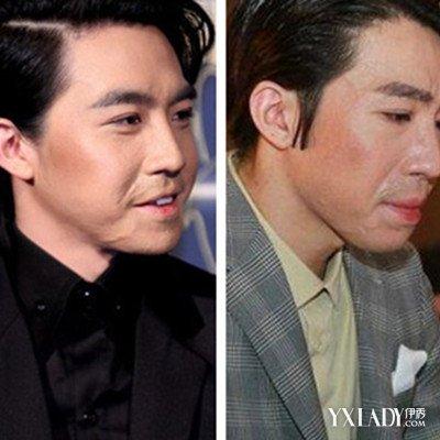 【图】俞灏明烧伤前后对比相差惊人 自曝重拾信心即将会有大动作