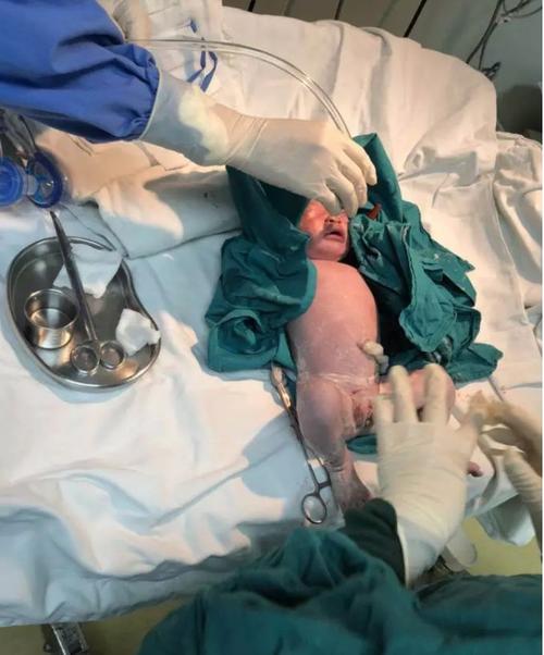 葡萄胎,早孕流产,孕6月死胎…广东这个女人经历那么多