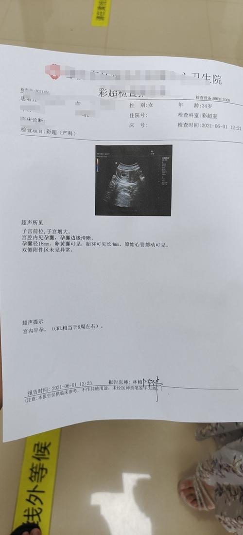 姐妹们,帮看一下移囊第30天的b超,孕囊是不是小了点