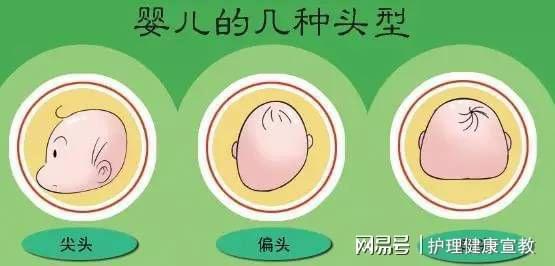 宝宝8个月还是扁头是不是不能纠正了