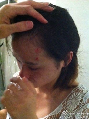 温州一女乘客仗义提醒防小偷遭围殴