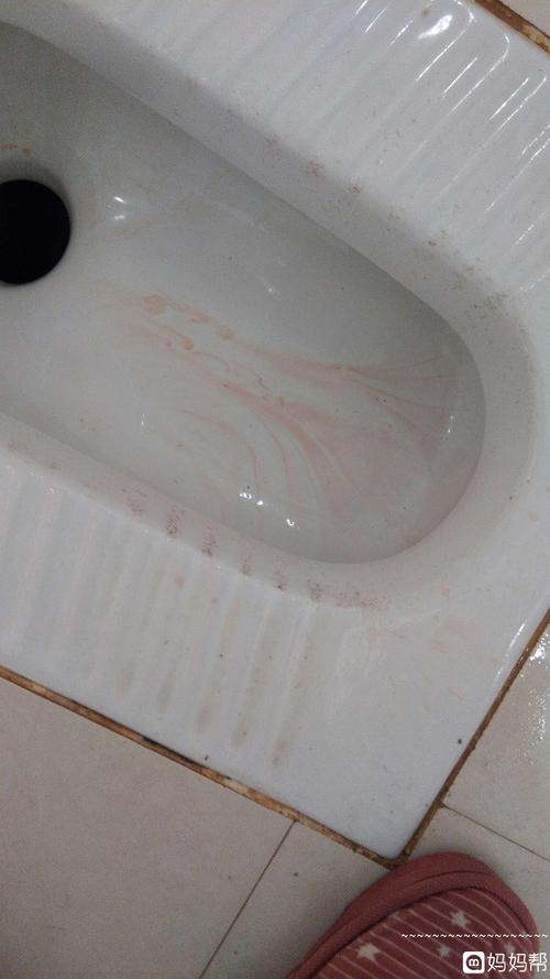 尿血是怎么回事