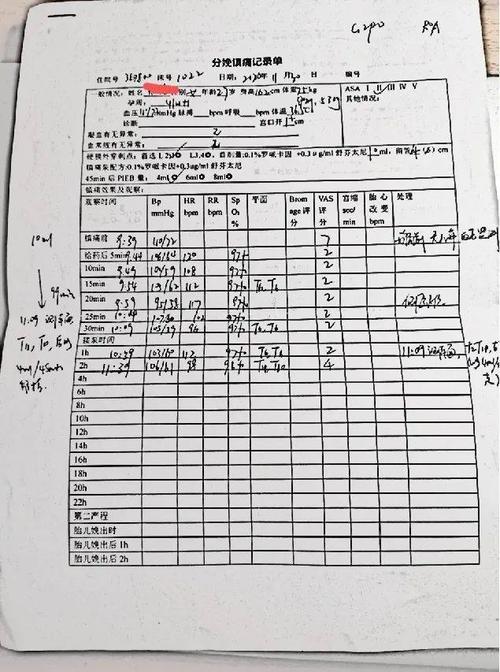 徐医附院麻醉科 | 一例分娩镇痛后突发室上速