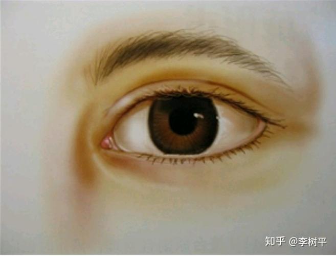 没有内眦赘皮的理想双眼皮,大眼睛,可以看到内眼角红色的小肉(泪阜).