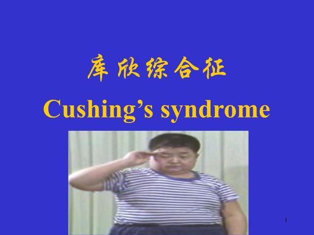小儿库欣综合征会严重影响孩子的体态和健康我们应该如何预防