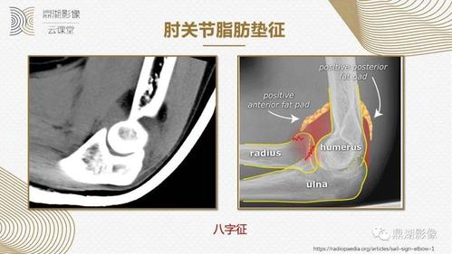 手第二节 腕第三节 前臂,肘关节第四节 肱骨第五节 肩胛骨,锁骨第六节