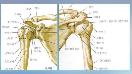肱骨大结节骨折