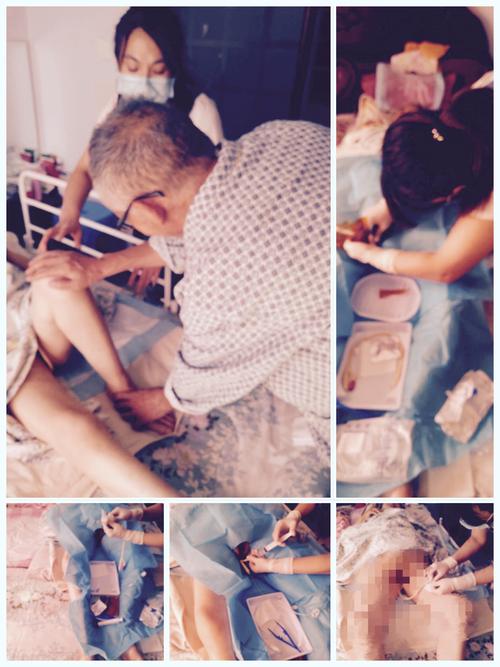 我科居家护理成员为患者进行留置导尿