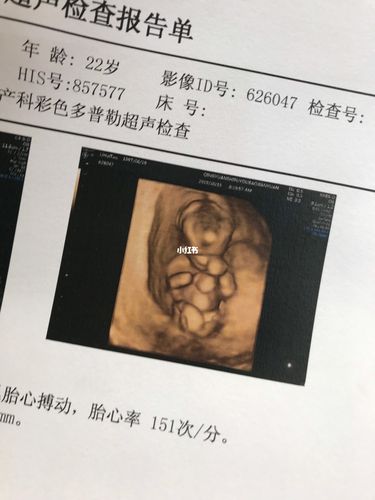 13周的胎宝宝就长得那么好了06_产检_nt检查_相册_母婴_孕产经验