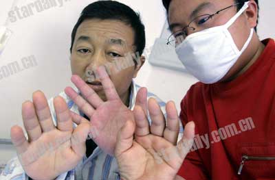 白血病人急缺稀有救命血 患者已找到可以移植的骨髓(图)