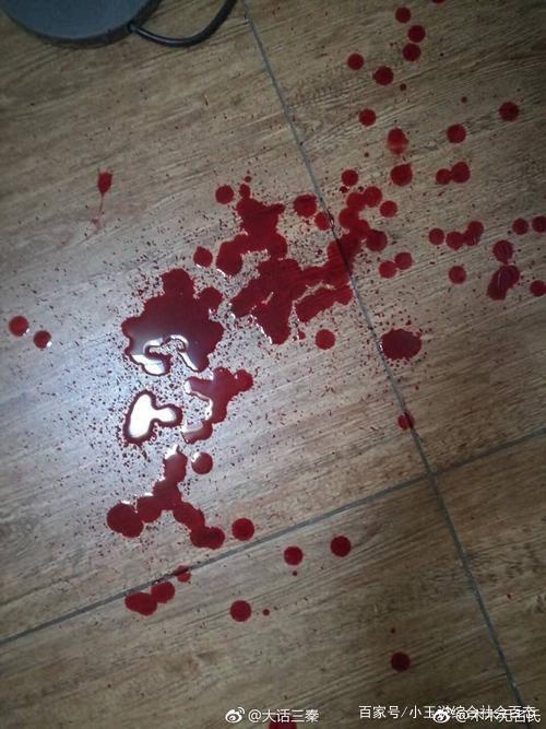 流血后的坚强乐观人生令人敬畏!