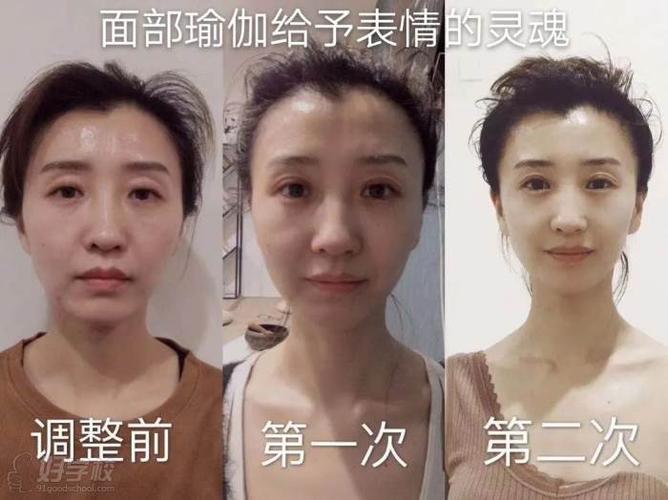 面部瑜伽
