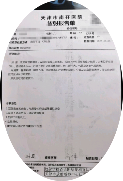 刘懿博士说肺癌二亖亖三发现肺结节为了快找家医院拍ct可以吗