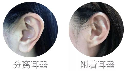 长辈总说耳垂大有福气,有道理吗?