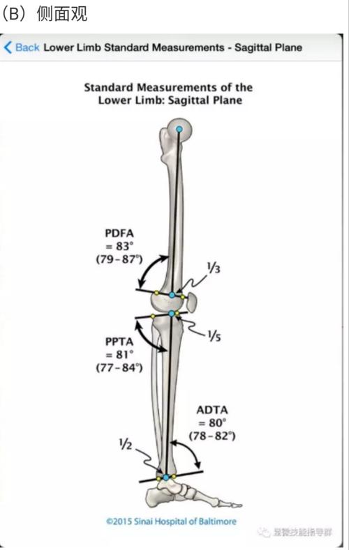 人体下肢力线和意义