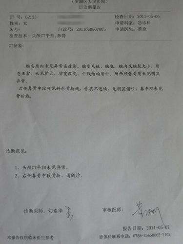 鼻骨骨折ct报告 头颅ct平扫2