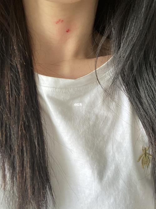 脖子被猫种草莓91了_草莓_猫粮_宠物_猫