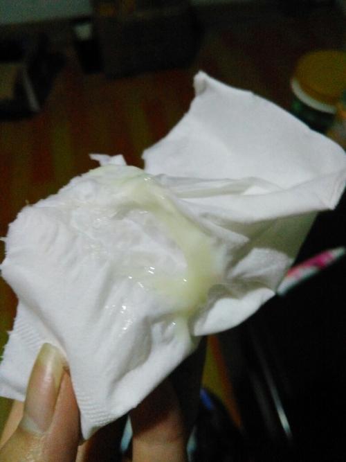 白带多然后是这个颜色的请问是因为什么 生过一个宝宝 现在是一岁半了