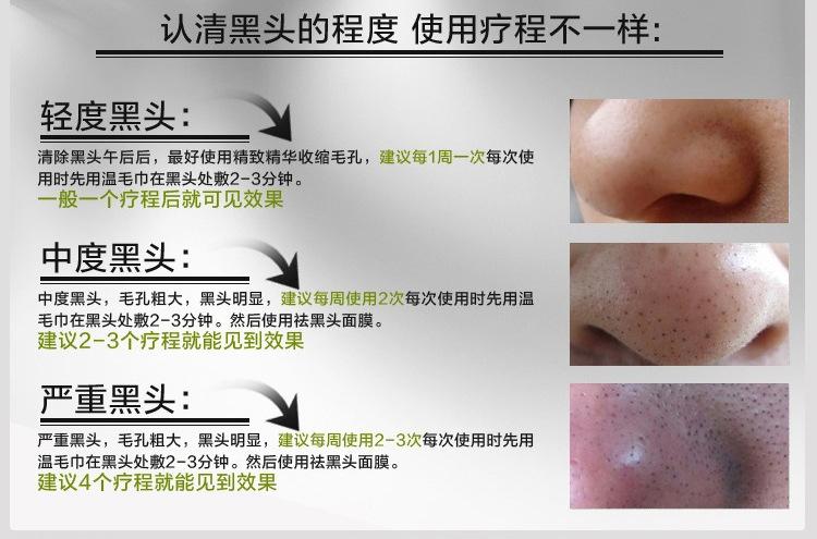 撕拉式面膜祛黑头排毒防痘导出鼻贴膜液收缩